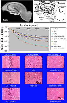 On the Origins of Diffusion MRI Signal Changes in Stroke